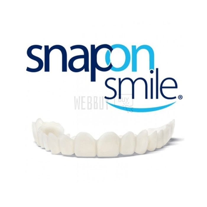 Snap-On Smile | veneer